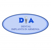 Dental Implants-Dia