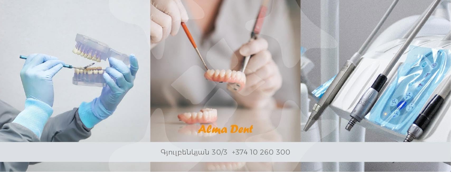 Алма Дент Стоматологическая Клиника